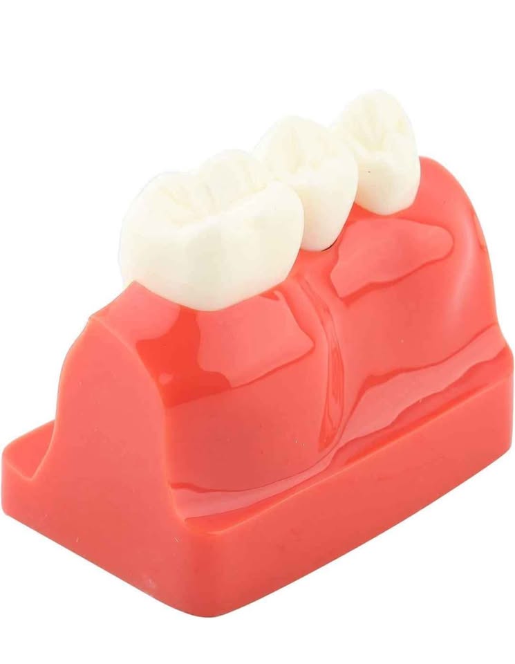 Implant Model Dental